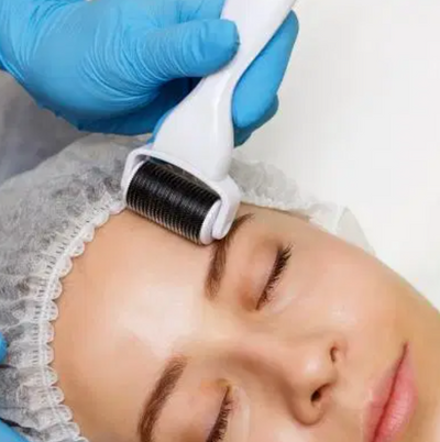 Microneedling Part 2: Aftercare 